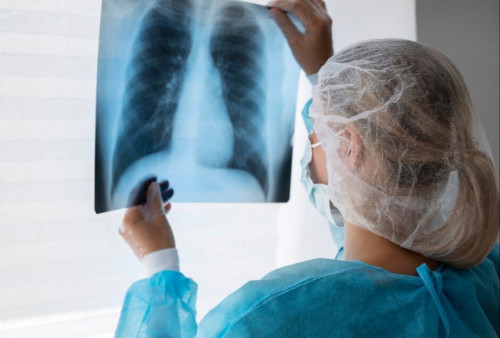 Peringatan Hari Tuberkulosis pada 24 Maret, Kasus TB di Indonesia Tertinggi Kedua di Dunia 