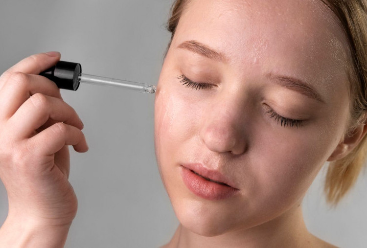 Wajah Berjerawat? Begini Urutan Skincare Routine yang Benar 