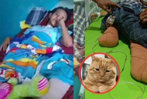 Heroik, Nabila Febriati Kehilangan Kaki Demi Selamatkan Kucing