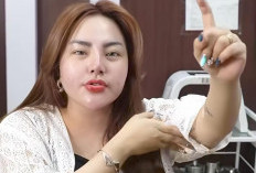 Ridwan Kamil Digugat Cerai Atalia, Lisa Mariana Malah Sibuk Pamer Hasil Operasi Bariatrik