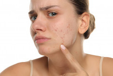 Kulit Mendadak Bruntusan? Ini 5 Cara Cepat Atasi Breakout Akibat Ganti Makeup
