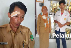 Miris! Niat Disiplin, Guru di Luwu Utara Jadi Korban Kekerasan Sampai Alis Kanannya Robek