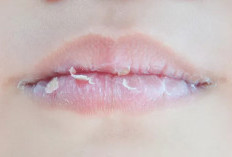 Bukan Cuma Dehidrasi, Ini 4 Penyebab Bibir Sering Pecah-Pecah yang Sering Diabaikan