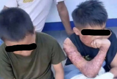 Sempat Viral di Media Sosial, Fakta Baru Kasus Pembakaran Tiga Santri di Lombok Tengah Terungkap