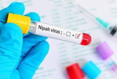 Peneliti BRIN: Virus Nipah Terdeteksi di Air Liur Kelelawar Sumatera, Kalimantan, hingga Jawa! 