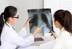 Ini Efek Samping Obat Tuberkulosis, Kenali Gejala sejak dini agar Hati Aman!