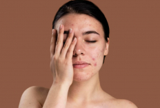 5 Cara Atasi Wajah Breakout akibat Skincare, Hindari Memegang Wajah!