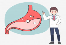 Puasa Aman atau Berbahaya bagi Penderita GERD? Ini Penjelasan Dokter