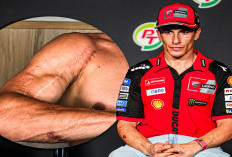 Bikin Merinding! Bekas Operasi Tangan Marc Marquez, Ducati Pastikan Sang Juara Dunia Kembali di Mugello