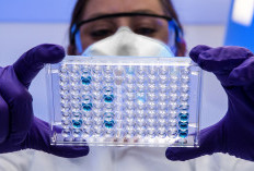 Tangkis Virus Nipah Masuk RI, Alat Deteksi Suhu di Bandara Disiagakan