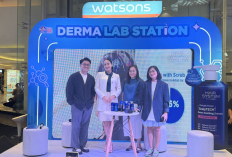 Ladies! Ini 4 Cara Mudah Usir Masalah Kulit Kepala, Dokter Nadia Alaydrus Bagikan Tips